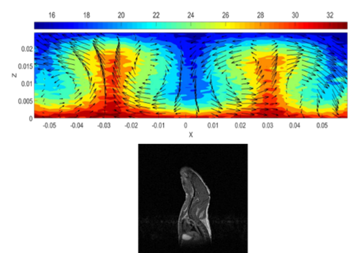 Image representing temperature and speed maps in glycerol as well as a section of the anterior part of a mouse.