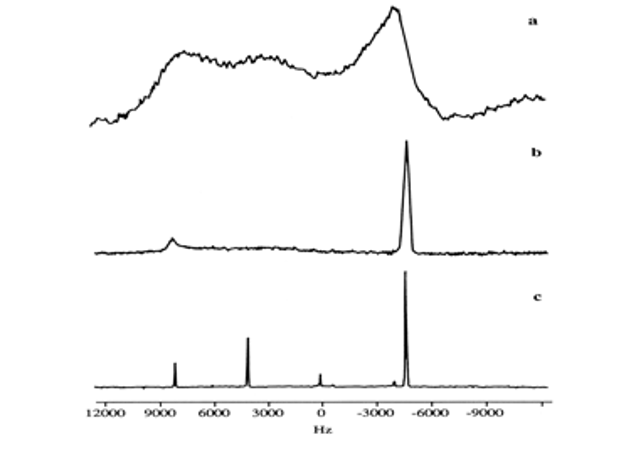 Image representing several solid-state NMR spectra of carbon-13 of hexamethylbenzene: "raw", with decoupling and with decoupling and rotation at the magic angle.