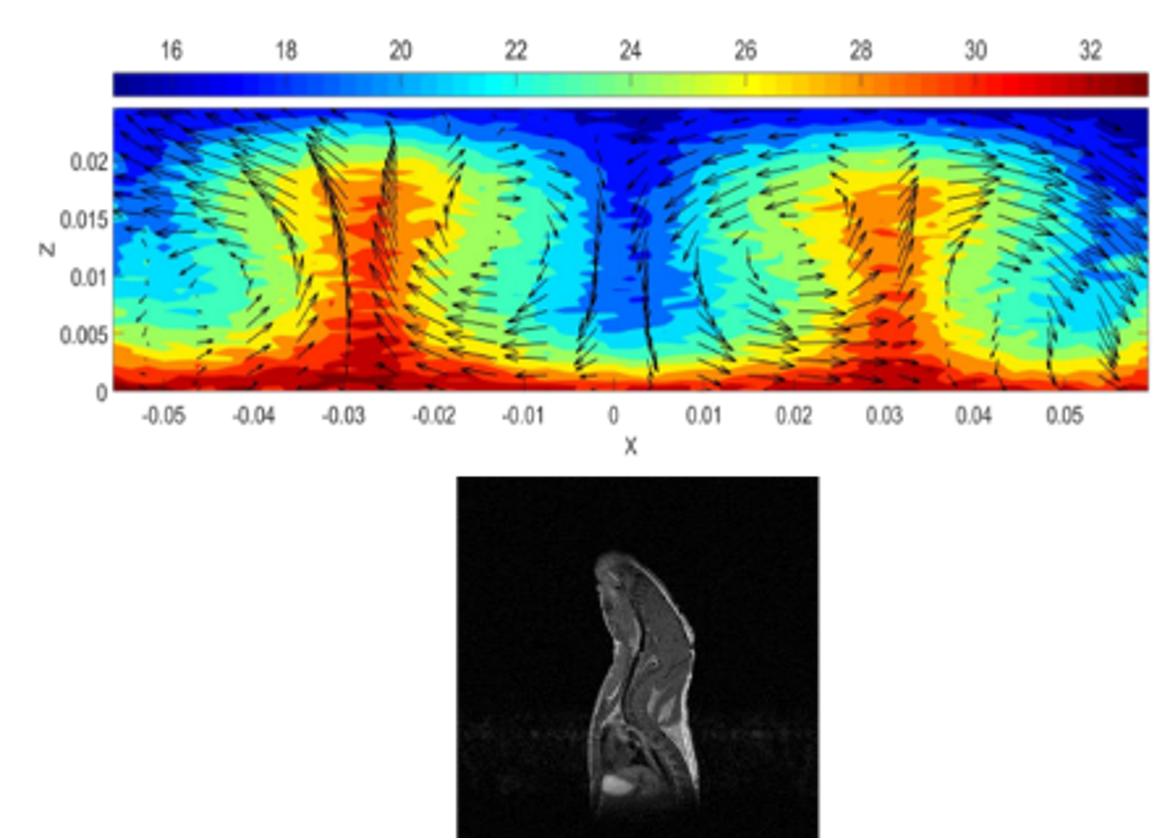 MRI experiments Image representing temperature and speed maps in glycerol as well as a section of the anterior part of a mouse.